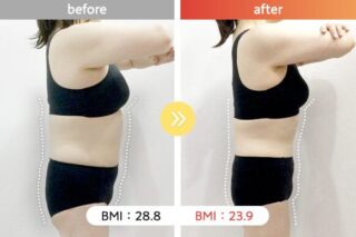 医療ダイエット