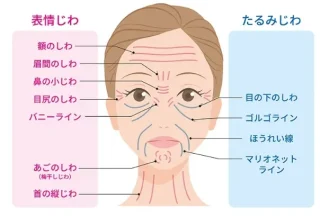 ほうれい線