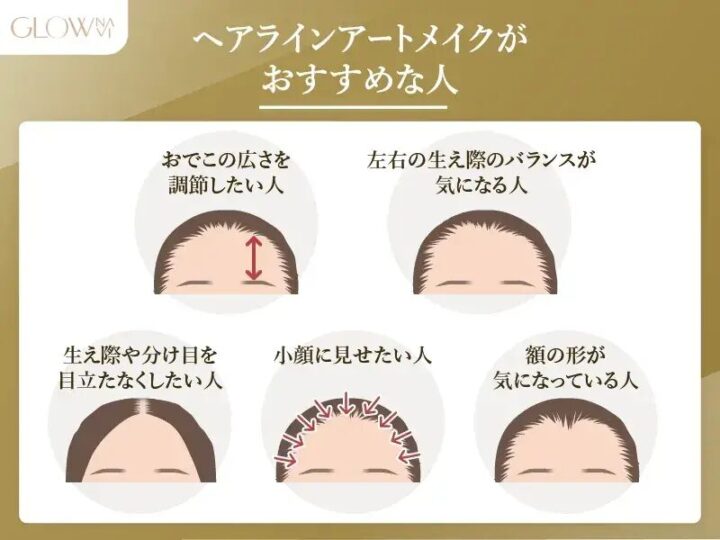 ヘアラインアートメイクがおすすめな人 おでこの広さを調整したい人 左右の生え際のバランスが気になる人 生え際や分け目を目立たなくしたい人 小顔に見せたい人 額の形が気になっている人