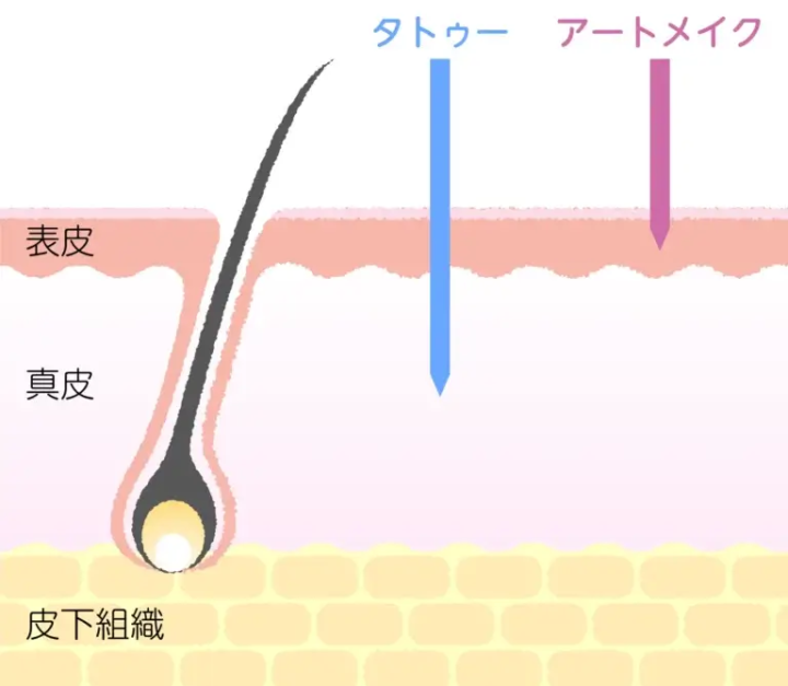アートメイクと入れ墨・タトゥーの違いの図 表皮に色素を入れるアートメイクと真皮に入れるタトゥーの比較