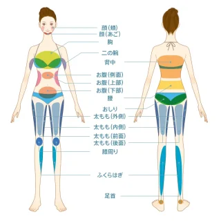 脂肪吸引　聖心美容クリニック