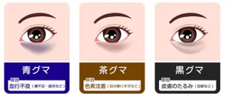 佐々木皮膚科 山形県 クマ治療