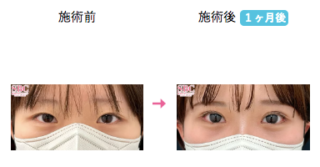 クイックコスメティーク・ダブルNeo 他