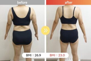 医療ダイエット