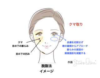 クマ取りイラスト