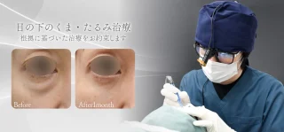 ウェンデルクリニック 目の下