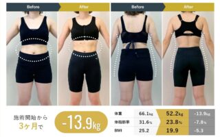 医療ダイエット
