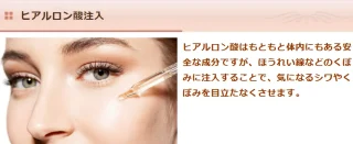 さくら美容外科クリニック　ヒアルロン酸注入　施術メニュー画像