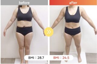 医療ダイエット