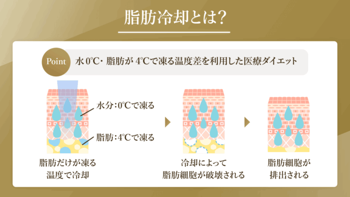 脂肪冷却の仕組み解説