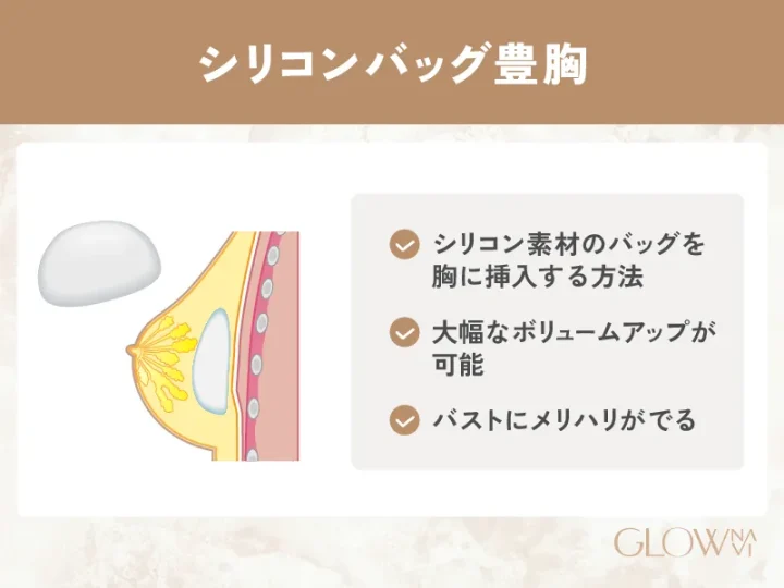 シリコンバッグ豊胸