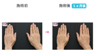 プロファイロ
