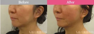 美肌アモーレ