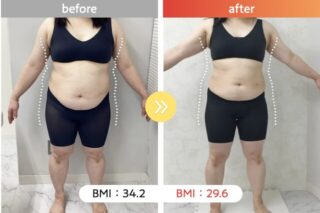 医療ダイエット