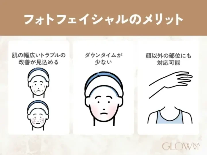 フォトフェイシャルのメリット
