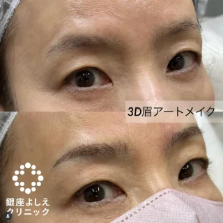 3D眉アートメイク2回セット