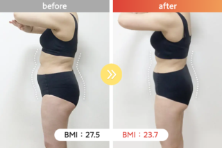 医療ダイエット