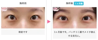 クイックコスメティーク・ダブルNeo