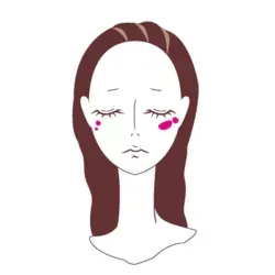 しみ