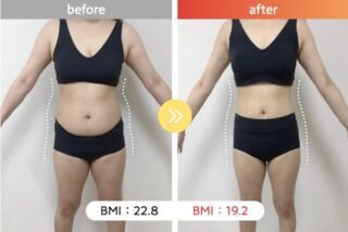 医療ダイエット