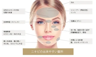 しわ、たるみ