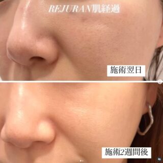 リジュラン