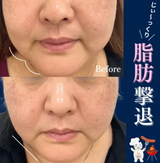 医療ハイフ