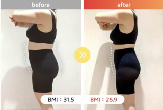 医療ダイエット