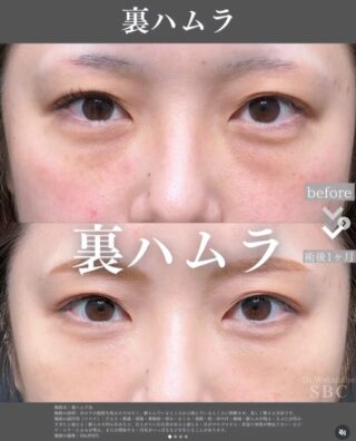 裏ハムラ