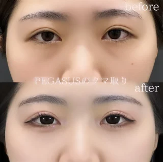 裏ハムラ