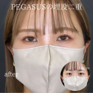 埋没二重premiumトリプルループ裏留め