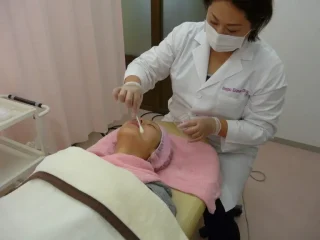 ピーリング
