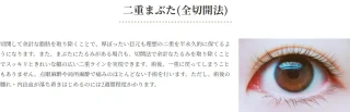 はらクリニック　二重まぶた（全切開法）施術メニュー画像