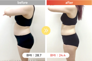 医療ダイエット