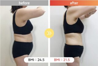 医療ダイエット