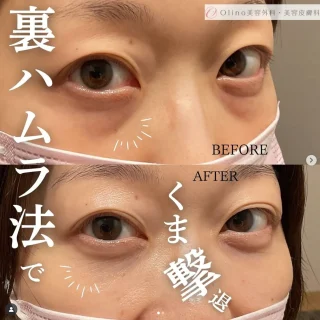 裏ハムラ