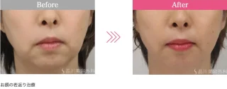 美肌アモーレ