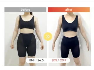 医療ダイエット