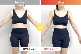 医療ダイエット