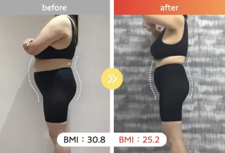 医療ダイエット