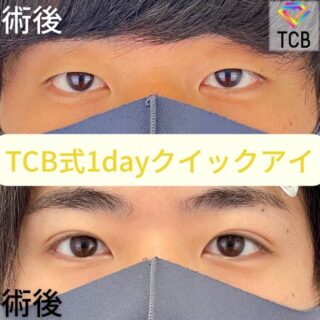 1dayクイックアイ
