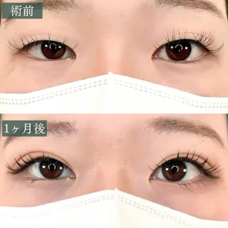 TCB式1dayクイックアイ