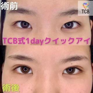 1dayクイックアイ
