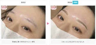 アートメイク（眉毛）