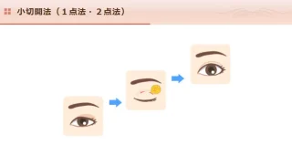さくら美容外科クリニック　小切開法　施術メニュー画像
