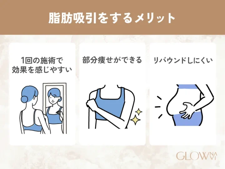 脂肪吸引をするメリット