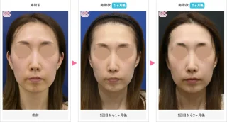 プロファイロ