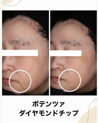ポテンツァ
