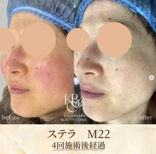 ステラ M22