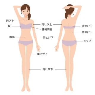 ステラ美容クリニック (脱毛)